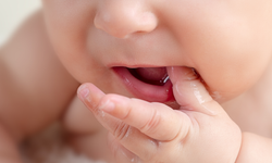 Bebeklerde Diş Çıkarma Dönemi ve Belirtileri Nedir? Bebeklerde Diş Çıkarma Belirtileri ve Çözümleri Nelerdir?