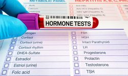 Hormon testi nasıl yapılır? Kadınlar için hormon testi