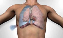 Akciğer sönmesi nedir? Akciğer sönmesi nasıl tedavi edilir?