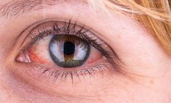 Göz Hastalıkları uzmanından glokom hakkında önemli bilgiler