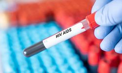 İzmir İl Sağlık Müdürlüğü'nden açıkalama: 13 yaşındaki çocuğun HIV virüsü nedeniyle ö*mesi...