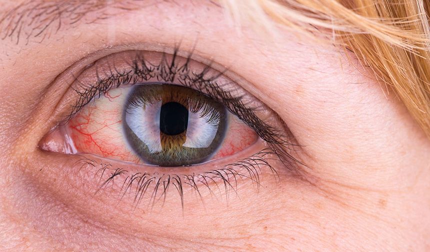 Göz Hastalıkları uzmanından glokom hakkında önemli bilgiler