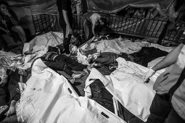 İsrail-Gazze savaşında kaç kişi hayatını kaybetti? Filistin Sağlık Bakanlığı açıkladı! Gazze Şeridin'de ölüm sayısı..